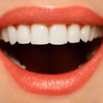 5 Signs You Need Dental Implants