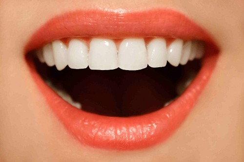 5 Signs You Need Dental Implants