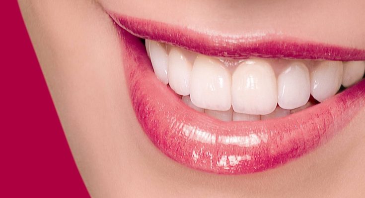 Everything You Need To Know About Caring For Porcelain Veneers