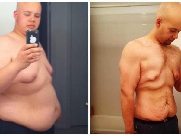 Weight Loss Is Only The Beginning