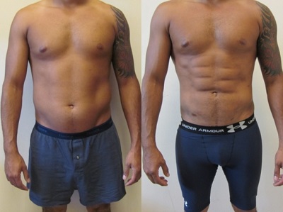 Why Are Tummy Tuck Surgeries Popular Among Men?